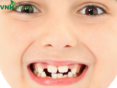 Một số mẹo giúp trẻ nhanh mọc răng